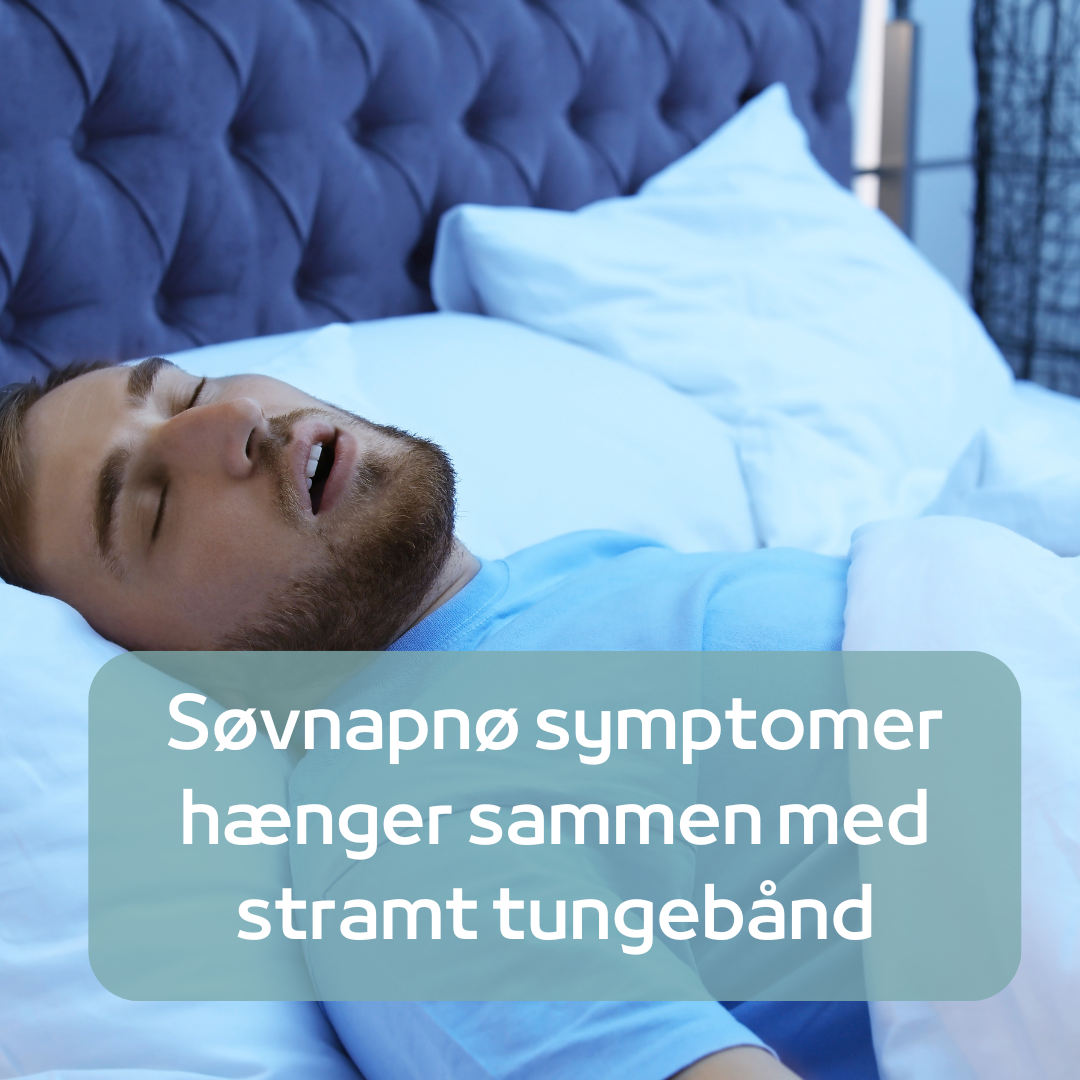 Er der sammenhæng mellem stramt tungebånd og søvnapnø  Ja i følge forskning
